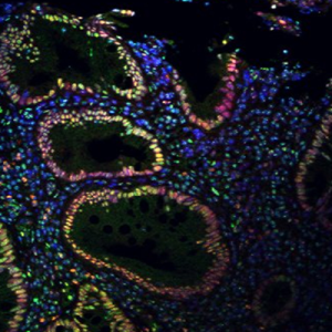 visualization of nerve cells