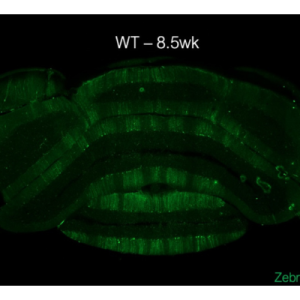striped pattern on purkinje cells