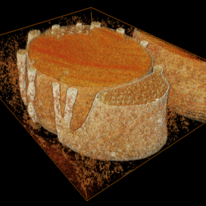 The accessory inner segment (aIS) of the eye.