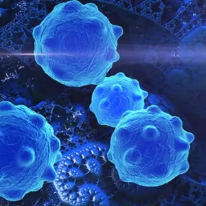 Image of brain tumor cells
