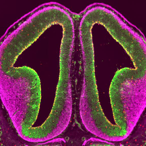 Mouse cortex
